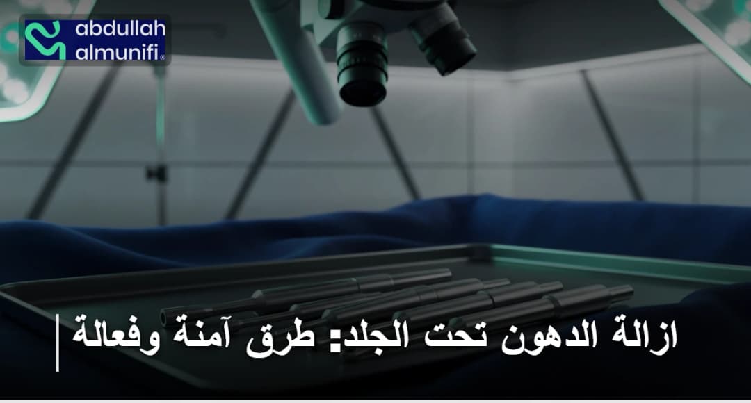 ازالة الدهون تحت الجلد