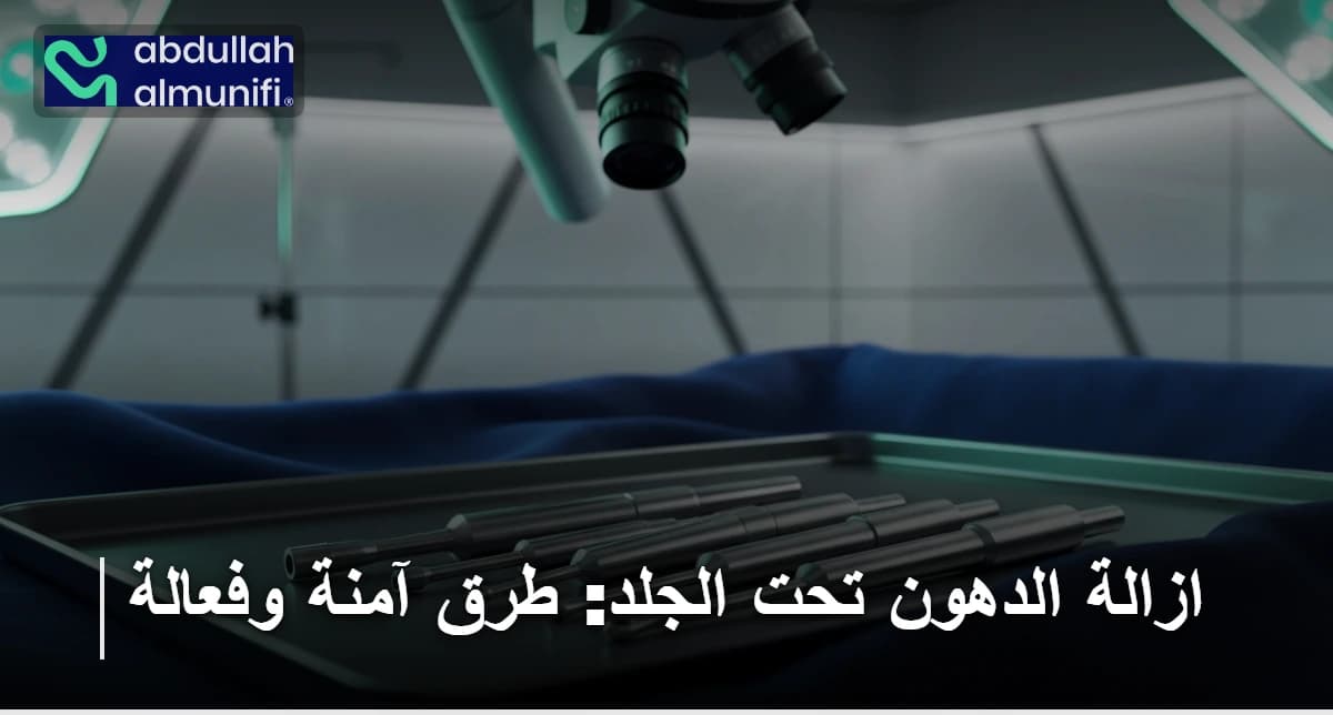 ازالة الدهون تحت الجلد