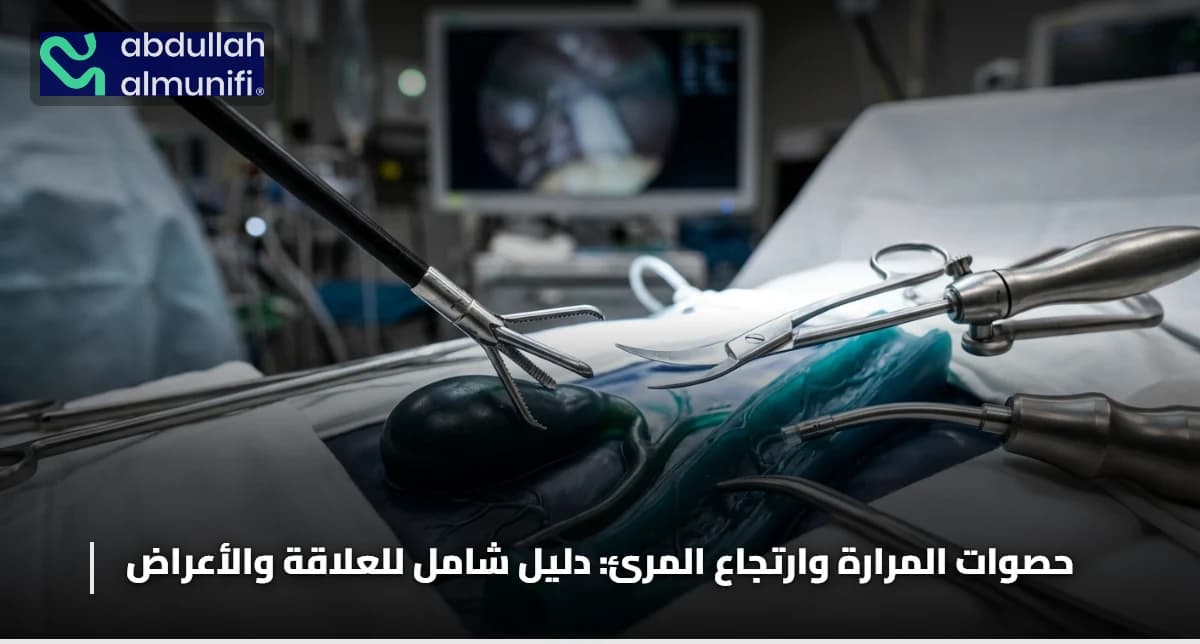 حصوات المرارة وارتجاع المرئ