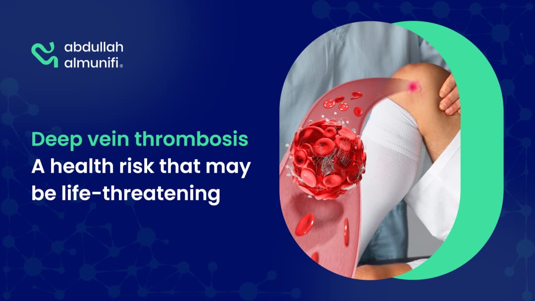 Deep Vein Thrombosis