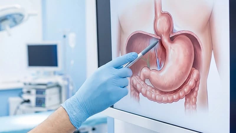 Endoscopy procedure diagnosing hiatal hernia with advanced medical imaging